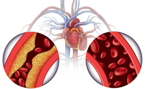Dihydromyricetin метки частного назначения OEM от порошка 98% dihydromyricetin выдержки чая лозы чая лозы
